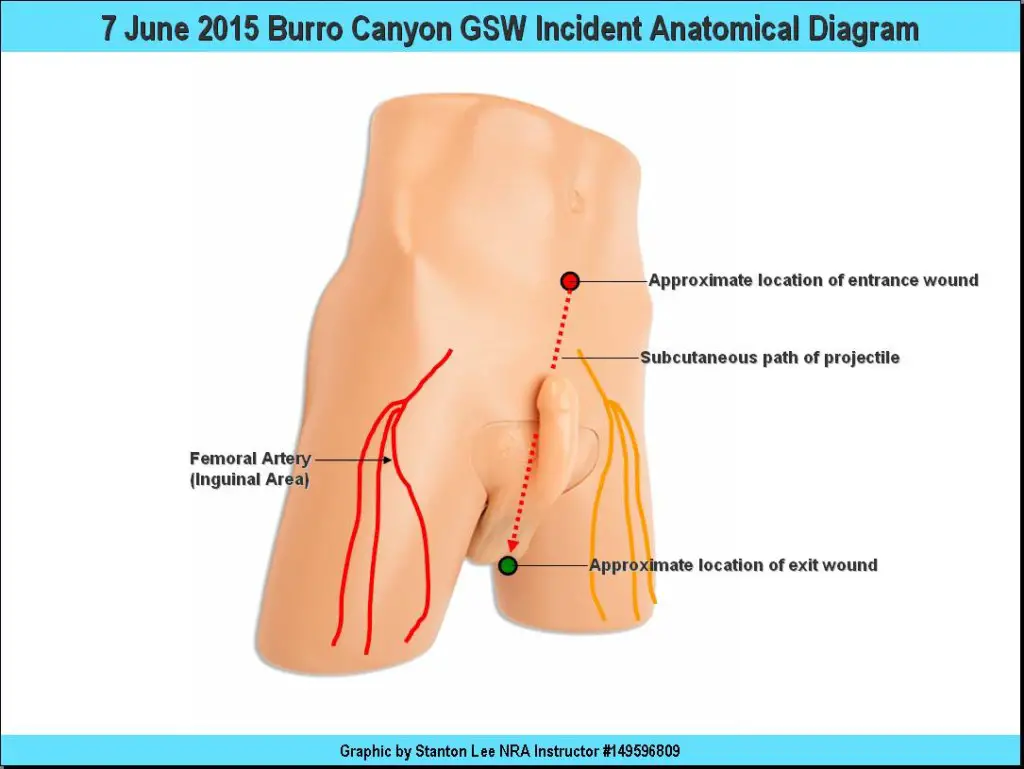 7-June-2015-Burro-Canyon-Gunshot-Wound-Incident